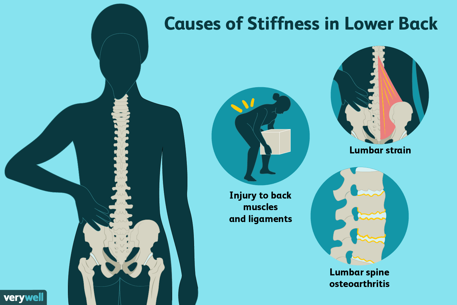 back stiff after switching from firm mattress